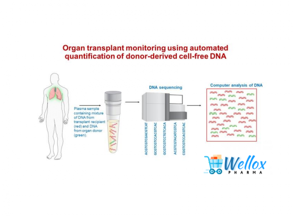 Be A Serious Avoider After Organ Transplant