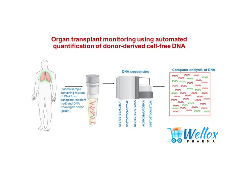 Be A Serious Avoider After Organ Transplant
