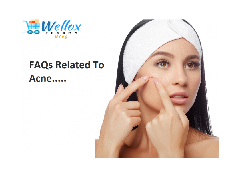 FAQs Related To Acne