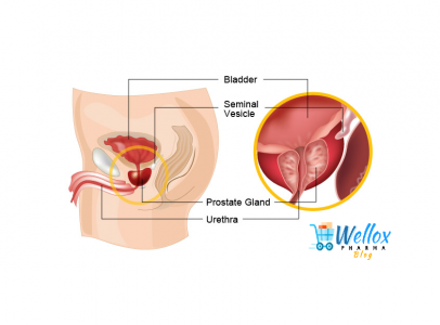 The Abcde Of Moles And Cancer