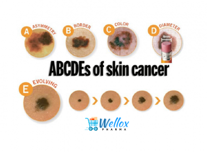 The Early Symptoms Of Breast Cancer