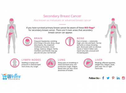 The Abcde Of Moles And Cancer